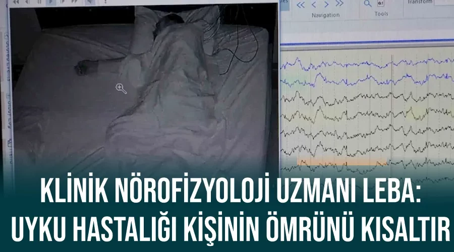 Klinik Nörofizyoloji Uzmanı Leba: 