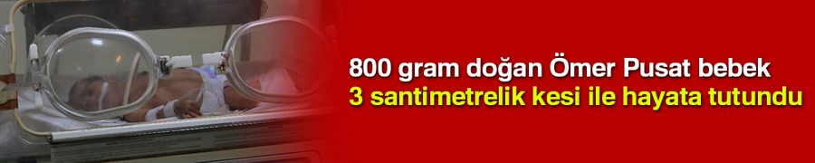 800 gram doğan Ömer Pusat bebek 3 santimetrelik kesi ile hayata tutundu